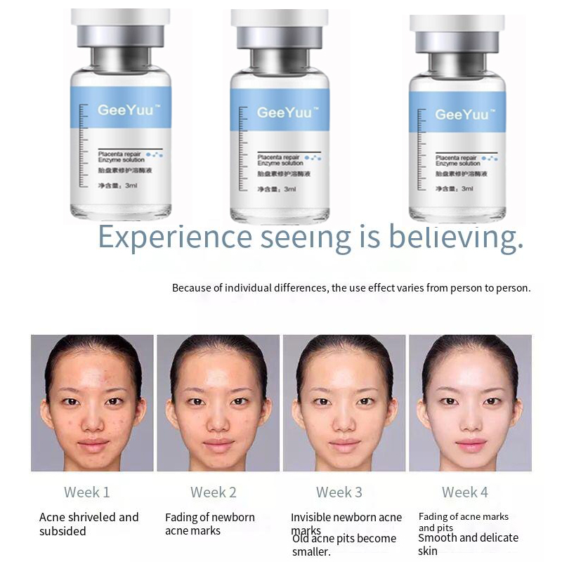 Placent Peptide Ampul Hyaluron - Placenta Extract Serum recensie en prijs
